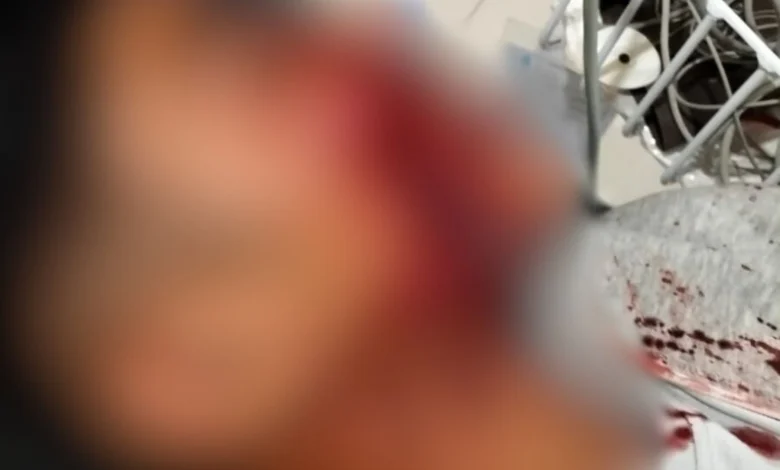 Kelompok Gangster Aniaya Anak di Bawah Umur