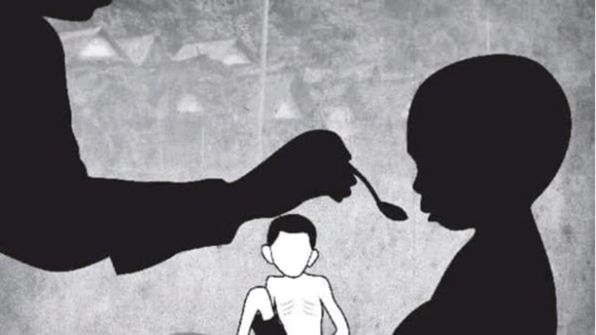 Ilustrasi Stunting dan Gizi Buruk NTB