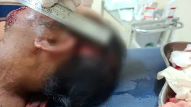 Warga Keruak Diduga Tebas Adik Kandung