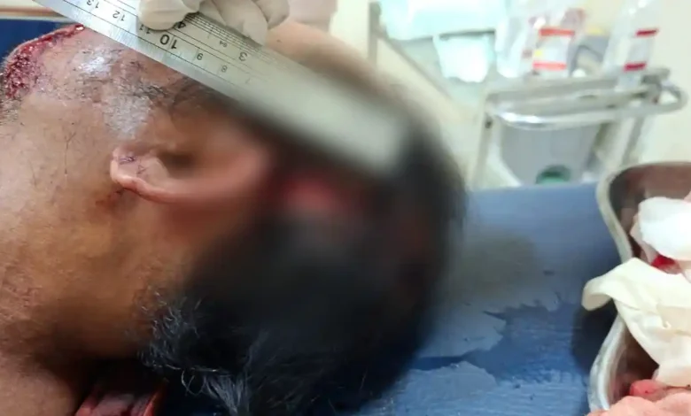 Warga Keruak Diduga Tebas Adik Kandung