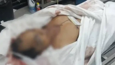 Warga Masbagik Diduga Jadi Korban Pencurian Organ di Malaysia Barat