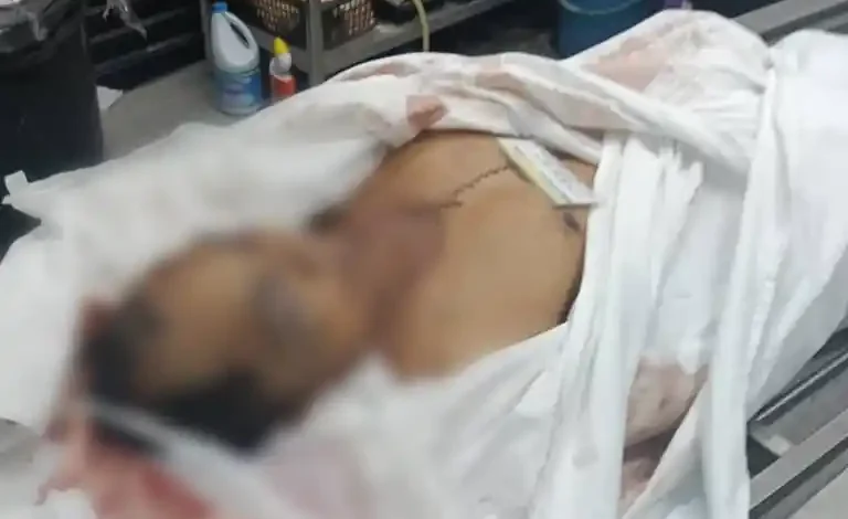 Warga Masbagik Diduga Jadi Korban Pencurian Organ di Malaysia Barat