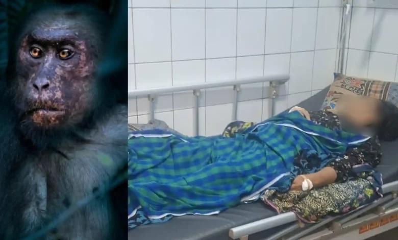 Warga Desa Pandan Indah Lombok Tengah Jadi Korban Gigitan Monyet Liar