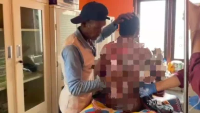 Korban Dugaan Pembakaran oleh Ibu Kandungnya di Plampang