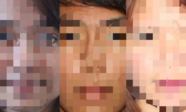 Kartel Keluarga Bandar Narkoba Koko Erwin Ditangkap