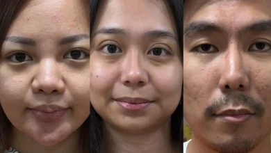 Istri dan Anak Koko Erwin juga Jadi Tersangka Pencucian Uang Kasus Narkoba