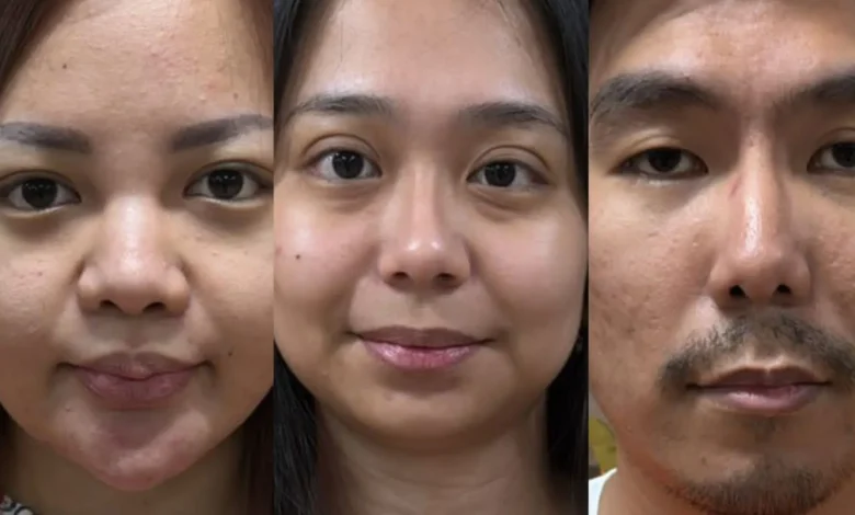 Istri dan Anak Koko Erwin juga Jadi Tersangka Pencucian Uang Kasus Narkoba