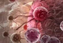 Ilustrasi kanker di NTB