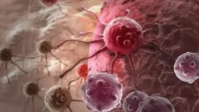 Ilustrasi kanker di NTB