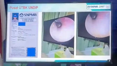 Salah satu modus kecurangan dalam UTBK-SNBT 2026 di Universitas Diponegoro (Undip) dengan menanamkan alat bantu dengar di liang telinga.