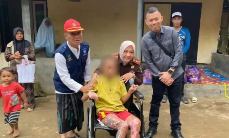 Santri korban dugaan pembakaran di Ponpes akan mendapat beasiswa pendidikan penuh dari Kanwil Kemenag NTB.