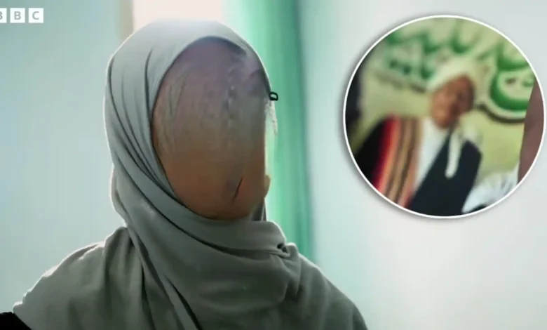 Korban dugaan pelecehan seksual di salah satu pondok pesantren di Lombok Tengah yang terjadi sejak lima tahun lalu.
